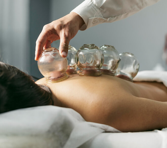 Therapist performing myofascial cupping therapy on a patient’s back at Flexify Physical Therapy in Allen, TX to relieve muscle tension and improve circulation.